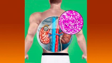 bd-manifestaciones-reumaticas-en-corazon-y-riñones-070121