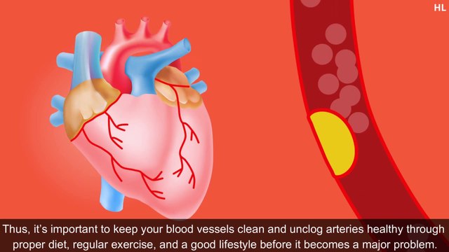 10 Foods That Unclog Arteries Naturally