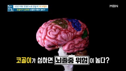 코골이가 심하면 뇌졸중 위험이 높다?
