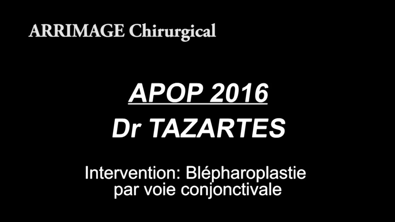 Chirurgie - Blépharoplastie par voie conjonctivale