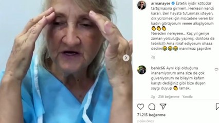 Ayşe Arman, 67 Yaşındaki kadının estetik ile değişimini paylaştı: "İnanılmaz şaşırdım"