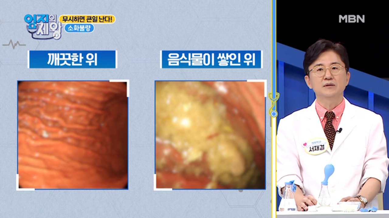 만성 질환 적신호! 위 건강을 사수하라