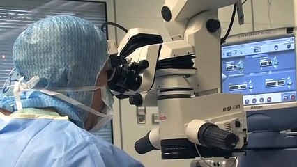 Test oépration cataracte 15 janvier 2021