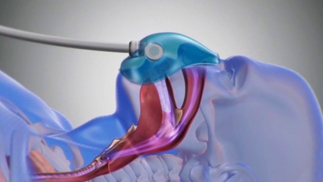 bd-soluciones-para-amnea-del-sueño-120121