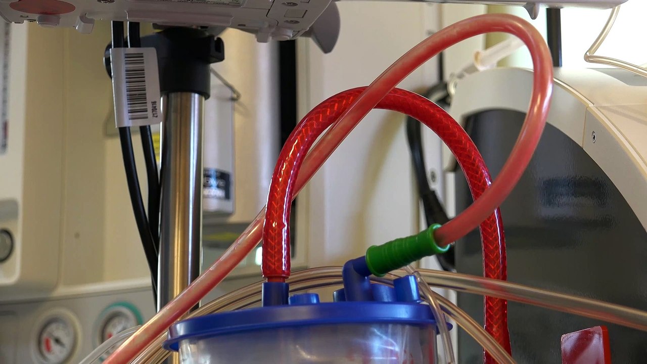 Tips on Getting the best liposuction in Singapore