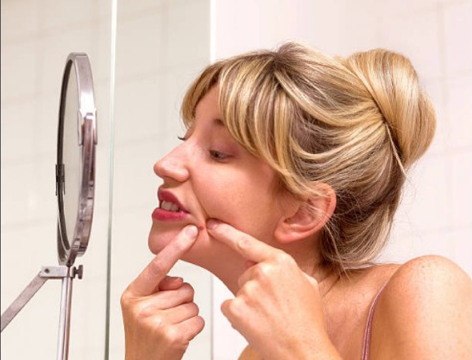 Los mejores métodos caseros para eliminar los granitos.