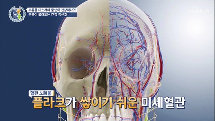 몸 속 주름이 보내는 건강 적신호 TV CHOSUN 210114 방송