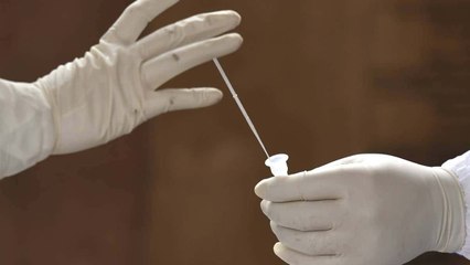 Continúan demoras con pruebas de covid-19 por EPS en Colombia