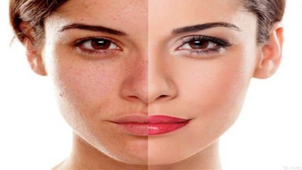 थके हुए चेहरे को देना है ग्लो तो अपनाए ये तरीका, चेहरा दिखेगा जवान । Boldsky