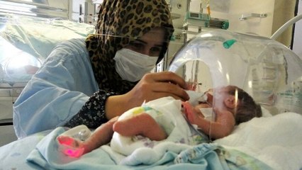 Parmak bebek, ayaksız olarak dünyaya geldi