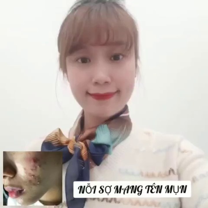 Mụn - nguyên nhân gây mụn và cách điều trị chính thống an toàn hiệu quả nhất #Shorts