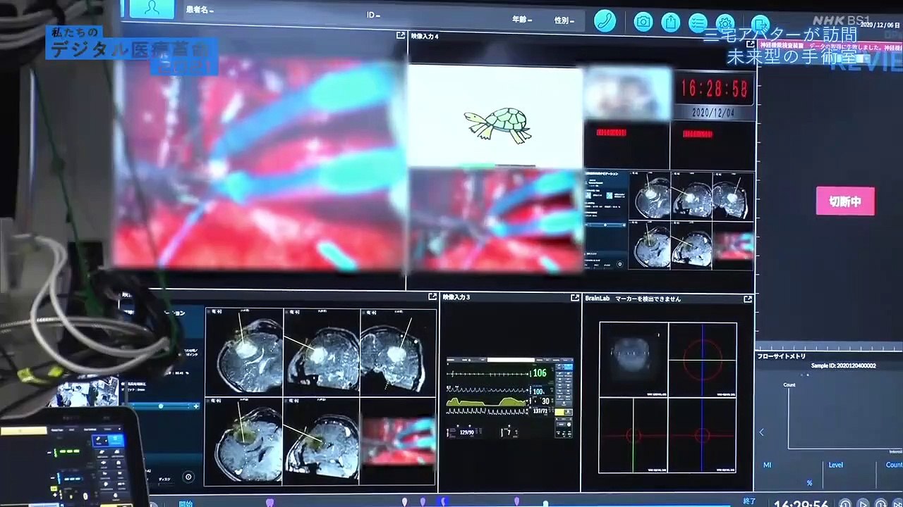 BS1スペシャル「私たちのデジタル医療革命2021」コロナ・ショックを追い風に、急激に進む医療のデジタル変革。がんや認知症の超早期発見AIとは？高齢者率５割の山村を救うデジタル実証実験とは？番組はAIやIoT、VR等のデジタル技術を活用し、日本の医療が抱える課題解決への挑戦を紹介する。PART2　2021年1月10日
