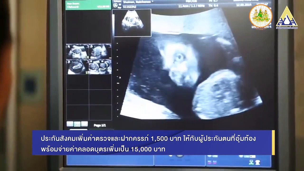 หลักเกณฑ์และอัตราสำหรับประโยชน์ทดแทนกรณีการฝากครรภ์ ตามพระราชบัญญัติประกันสังคม