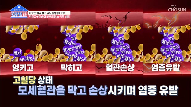 실명까지 유발하는.. 평생 관리 질병 ˹당뇨˼ TV CHOSUN 20210118 방송