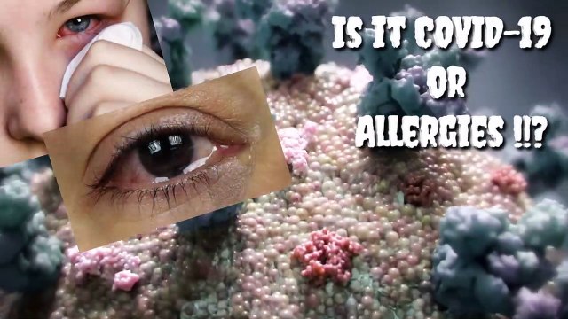 Is it COVID 19 Conjunctivitis or simple Seasonal Allergies.... _ Dr Saurabh Shah _ Gujarati