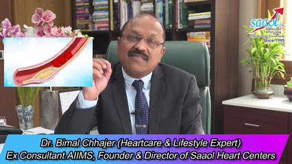 Descargar video: Saurav Ganguly Heart attack was stenting needed - Dr. Bimal Chhajer - Saaol - Health Care - Mystery Tube