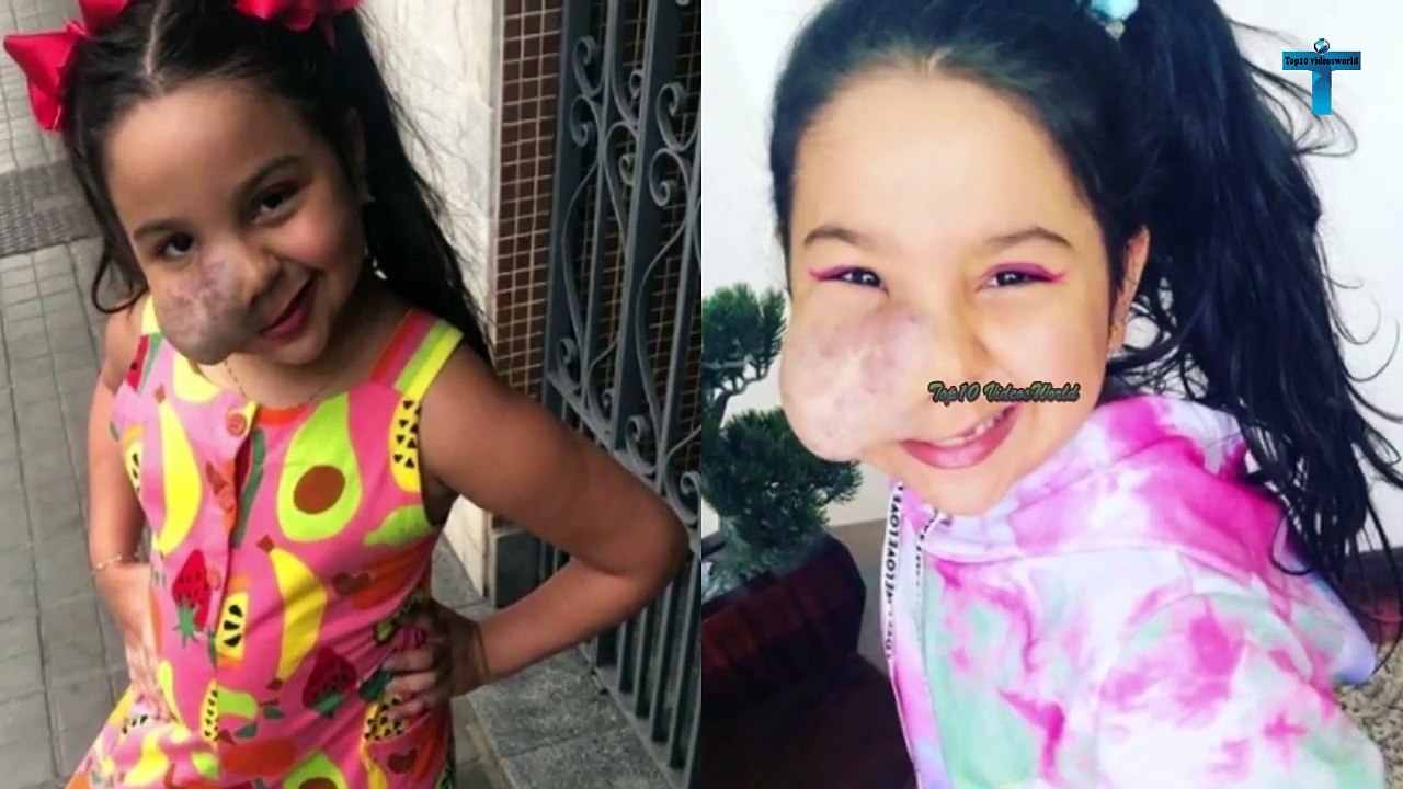 Top 10 Most Unusual Kids Born With Unbelievable Medical Conditions ...