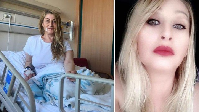 Estetik ameliyat sonrası dudağı çürümüştü… Songül için güzel haber