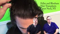 Parting with Hairloss- Feller and Bloxham Hair Transplants- New York