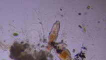 Rotifers (wheels) under a microscope from watering birds