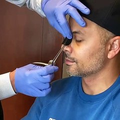 Rhinoplasty reveal See this patients reaction to her new nose