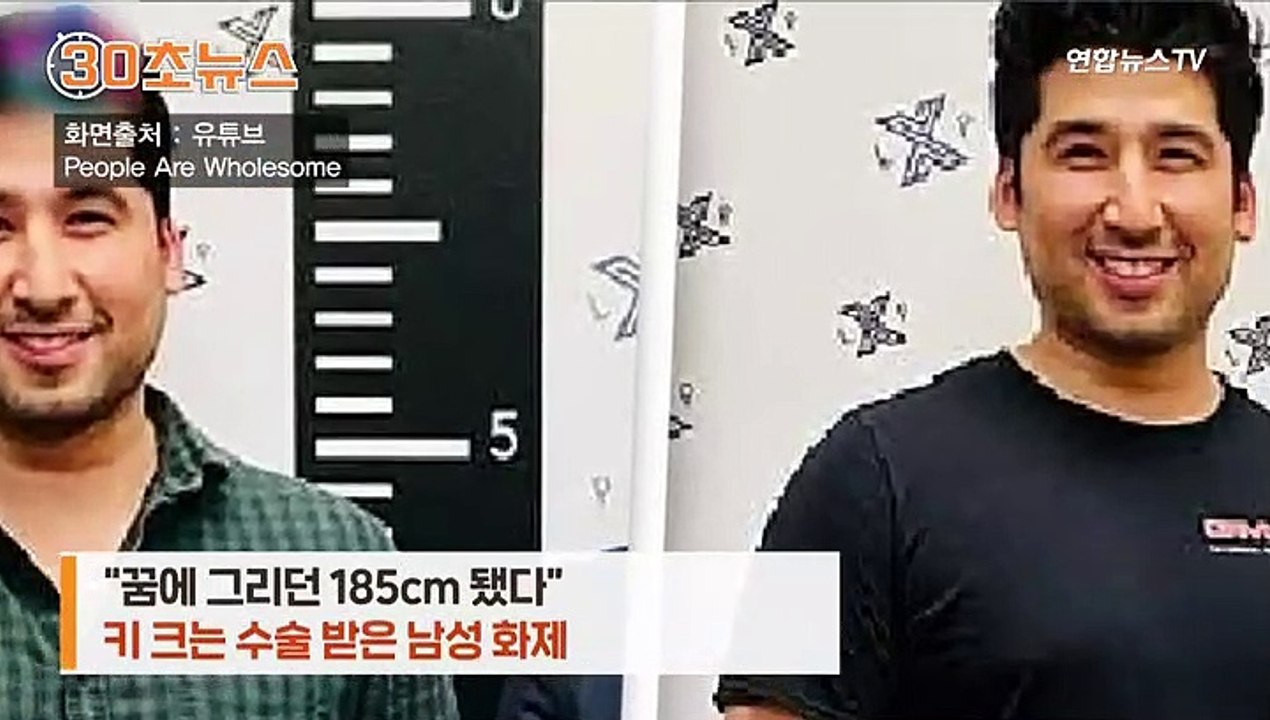 [30초뉴스] 하룻새 5cm '쑤욱'…키 크는 수술 받은 28세 남성 후기