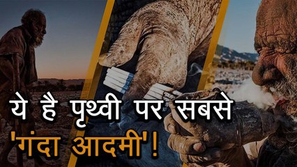 पृथ्वी पर सबसे 'गंदा आदमी'! 67 साल से नहीं नहाया ये बुजुर्ग, बगल में 1 सेकंड खड़ा होना भी मुश्किल
