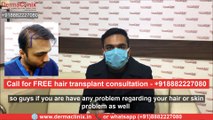 Hair Transplant in Delhi | Best Hair Transplant | Dr Amrendra Kumar- Hair Transplant Doctor in Delhi