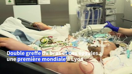 Un Islandais greffé des deux bras à Lyon, une première mondiale
