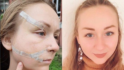 Falçata vahşetini anlattı… Hanna, korku içerisinde yaşıyor