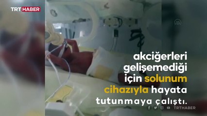 425 gramlık 'Nefes' 144 gün sonra evine kavuştu