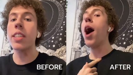 จัดว่าเด็ด ! หนุ่มพิสูจน์วิธีลบรอยดูดภายใน 5 นาที ทำได้ง่าย ๆ ด้วยสิ่งนี้