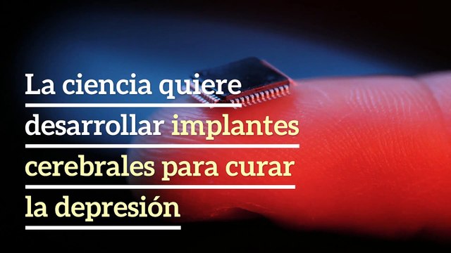 La ciencia quiere desarrollar implantes cerebrales para curar la depresión