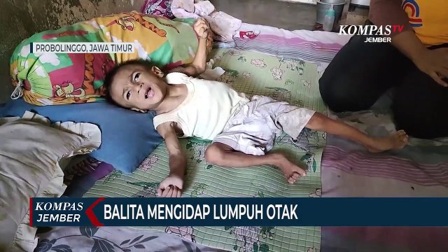 Balita dari Keluarga Miskin Mengidap Lumpuh Otak, Tak Tersentuh Pengobatan Rumah Sakit