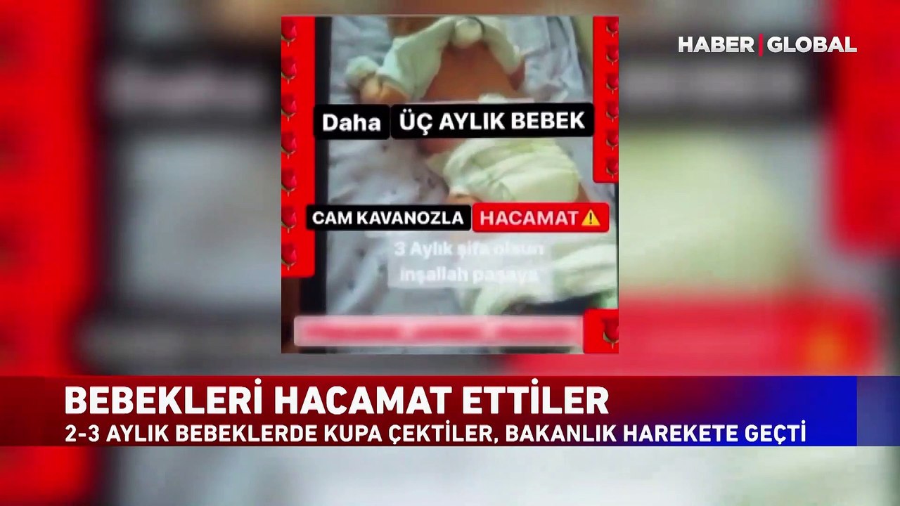 2-3 aylık bebeklere hacamat yaptılar, bakanlık harekete geçti