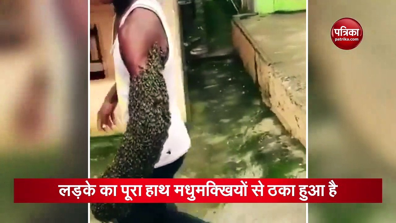 Bees have created a hive on the boy's entire hand