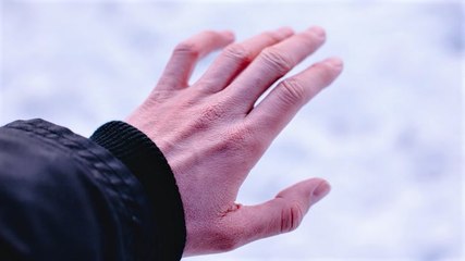 Frostbite, hypothermia: How to stay safe in extreme cold weather