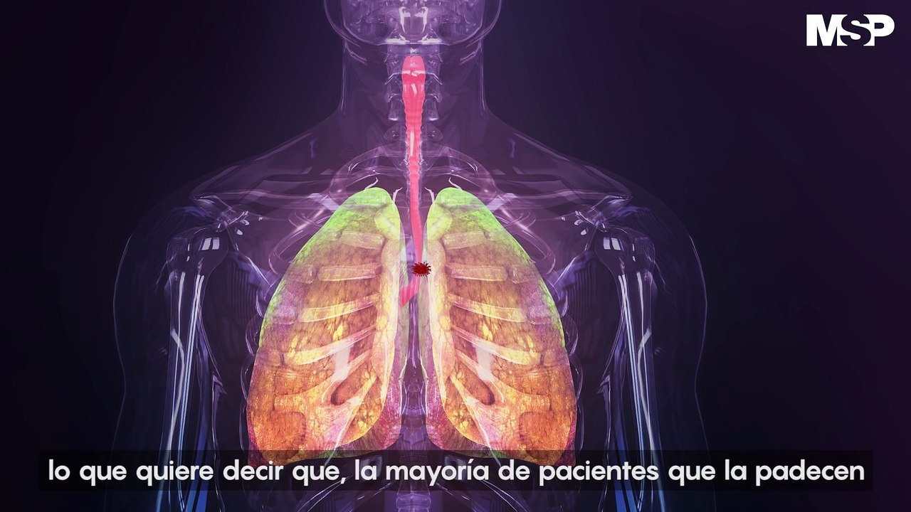 Así ataca el coronavirus al cuerpo humano_1080p