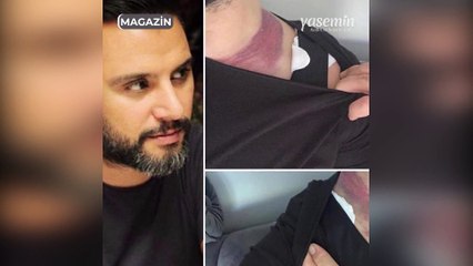 Estetik mağduru olan Alişan Adliye'de