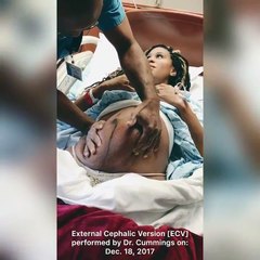 Ce docteur remet un bébé dans le bon sens juste avant un accouchement