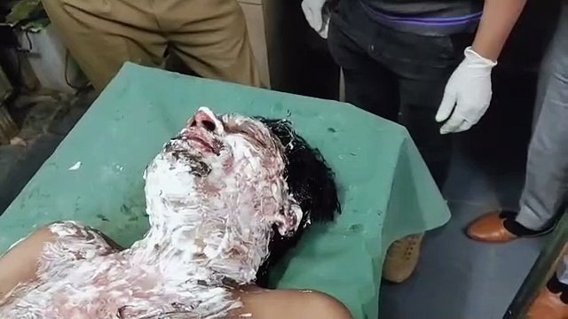 युवक ने खुद को आग लगाकर आत्महत्या का किया प्रयास