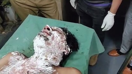 युवक ने खुद को आग लगाकर आत्महत्या का किया प्रयास