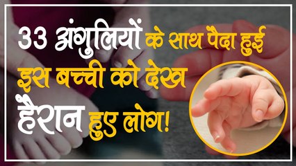 33 अंगुलियों के साथ पैदा हुई बच्_ची, इलाज कर रहे डॉक्टरों के भी उड़े होश! वायरल हो रही तस्वीर