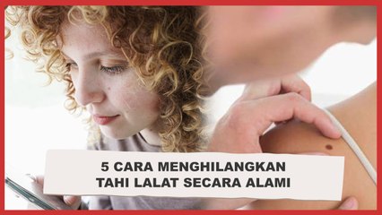 Ajaib! Ini 5 Cara Menghilangkan Tahi Lalat Secara Alami