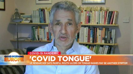 'COVID tongue': Mouth ulcers or rashes likely a coronavirus symptom, says expert