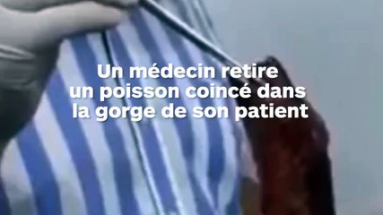 Un médecin lui enlève un poisson coincé dans sa gorge