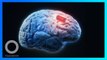 Implan Otak Seukuran Garam Untuk Manipulasi Stres - TomoNews