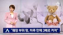 7개월 영아 첫 진료 의사 “멍 하루 만에 3배로 커져”