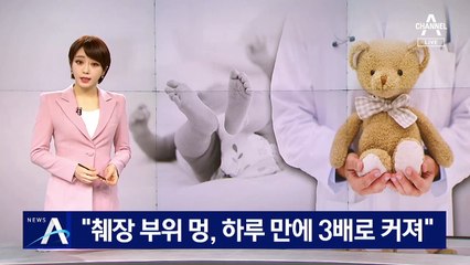 7개월 영아 첫 진료 의사 “멍 하루 만에 3배로 커져”