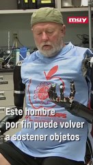 Este hombre perdió los brazos, pero unas prótesis robóticas cambiaron su vida